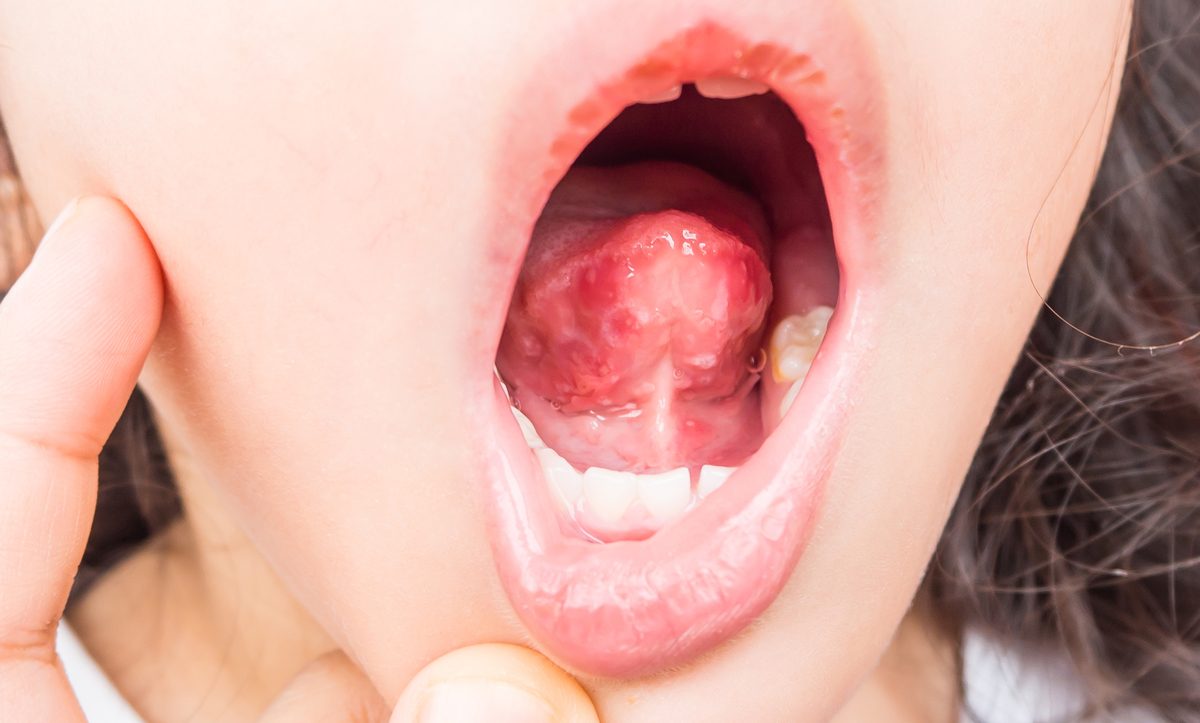 Dezenfeksiyon Hijyenix