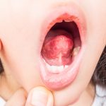 Dezenfeksiyon Hijyenix