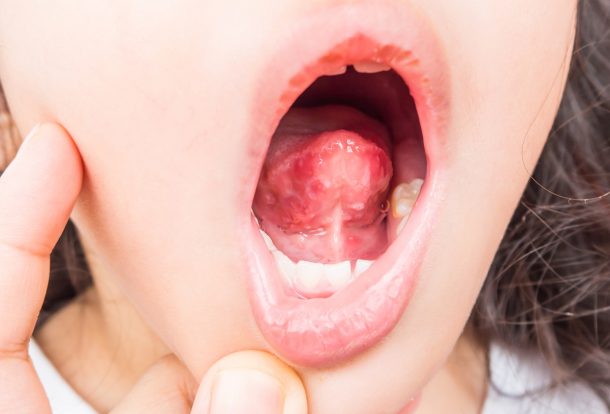 Dezenfeksiyon Hijyenix