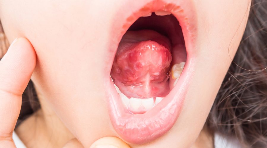 Dezenfeksiyon Hijyenix