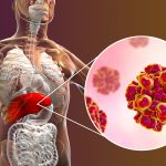 Dezenfeksiyon Hijyenix