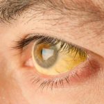 Dezenfeksiyon Hijyenix