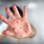 Dezenfeksiyon Hijyenix