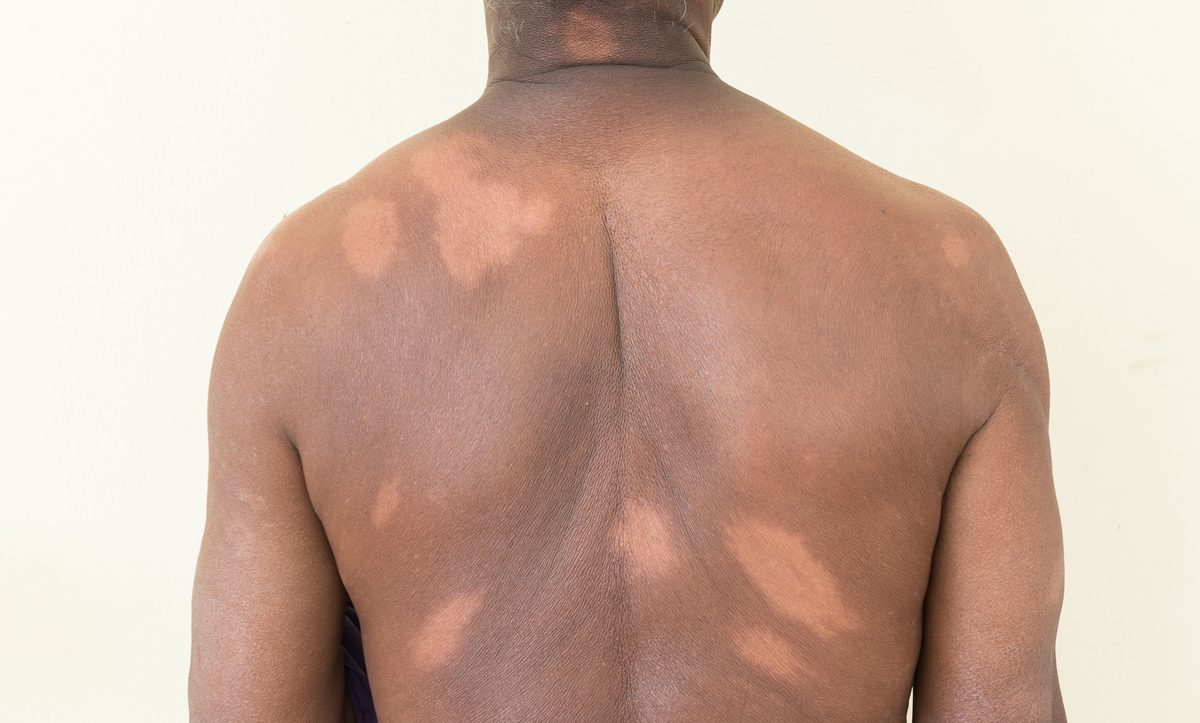 Dezenfeksiyon Hijyenix