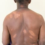 Dezenfeksiyon Hijyenix