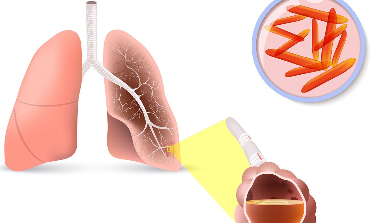 Dezenfeksiyon Hijyenix