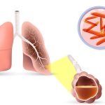 Dezenfeksiyon Hijyenix